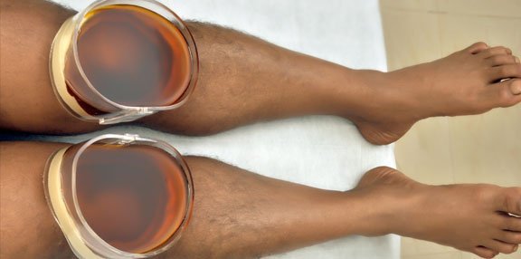 https://www.itoozhiayurveda.in/wp-content/uploads/2017/12/Joint-Pain-Treatment-in-Ayurveda.jpg